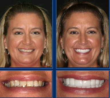 Austin Cosmetic Dentistry Can Get You Ready for That Special Event