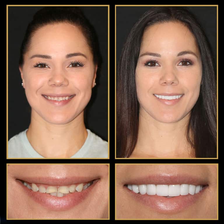 affordable dental financing