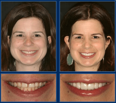 an austin cosmetic dentist understands the science of smiling