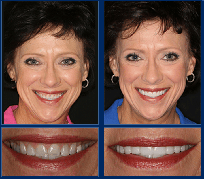 austin cosmetic dentist can create life changing smiles