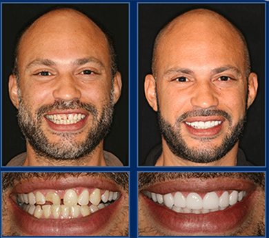 austin cosmetic dentist can transform your smile