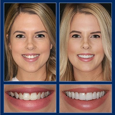 austin cosmetic dentist