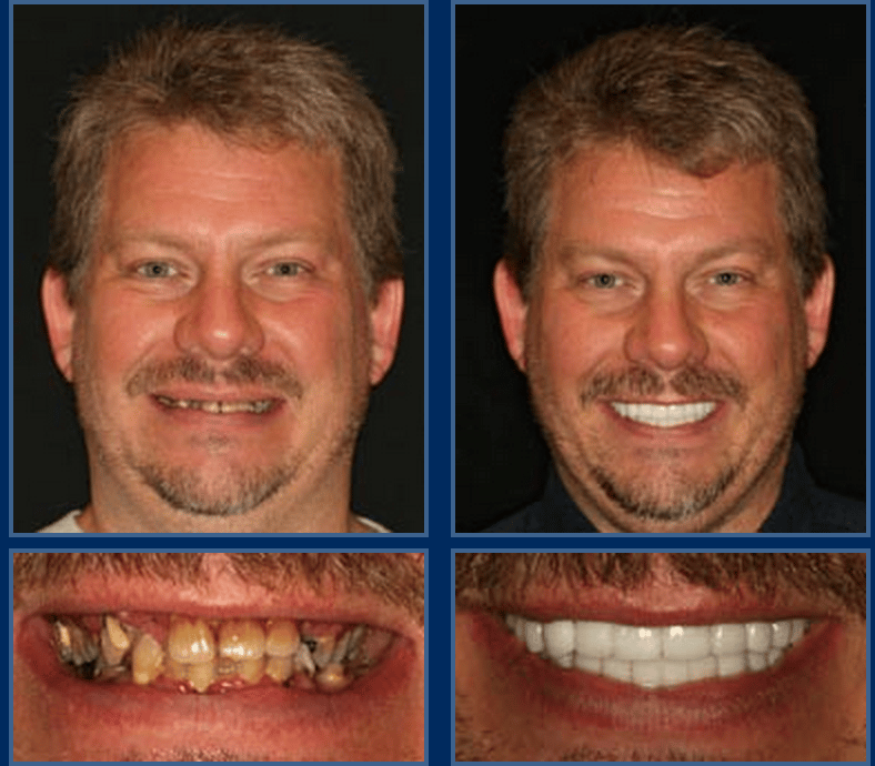 austin cosmetic dentistry at its best the value of a beautiful smile