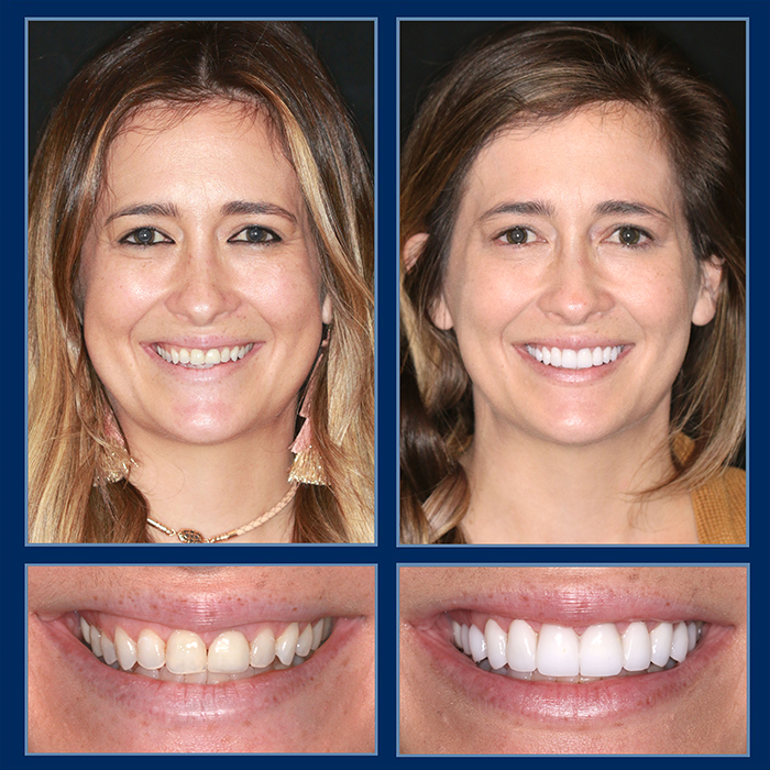 austin cosmetic dentists