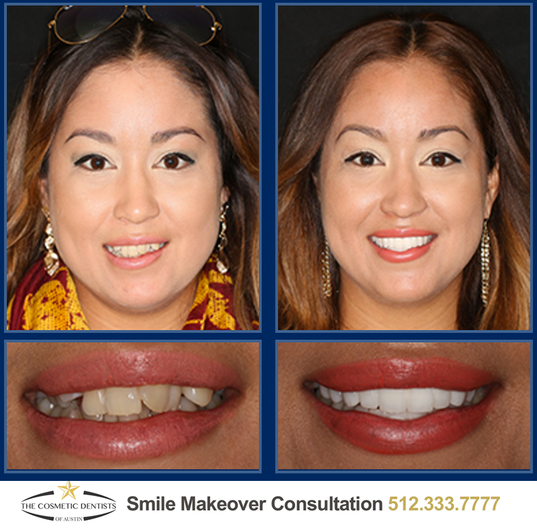 austin sedation dentistry