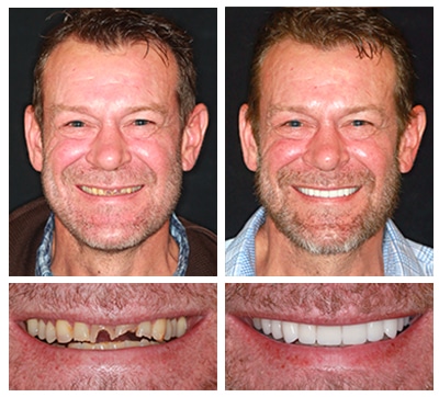 complimentary cosmetic dentistry consultation
