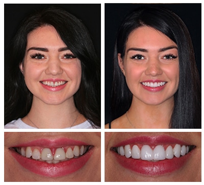 complimentary dental implants consultation