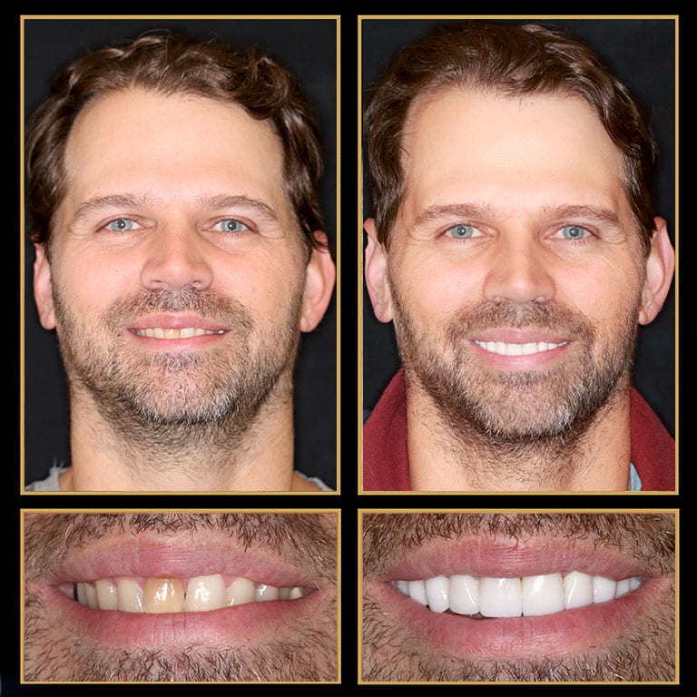 cosmetic dentistry austin