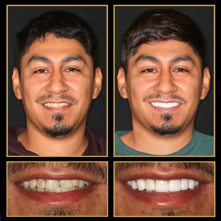 cosmetic dentistry fianancing
