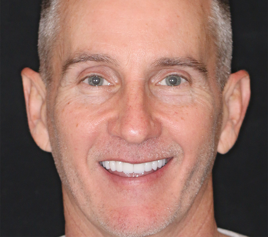 cosmetic orthodontics Austin TX