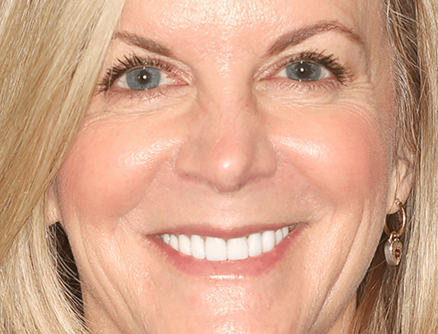 dental implants Austin TX