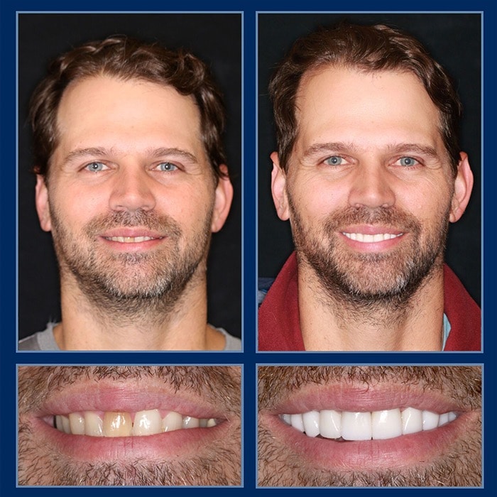 smile makeoever cost