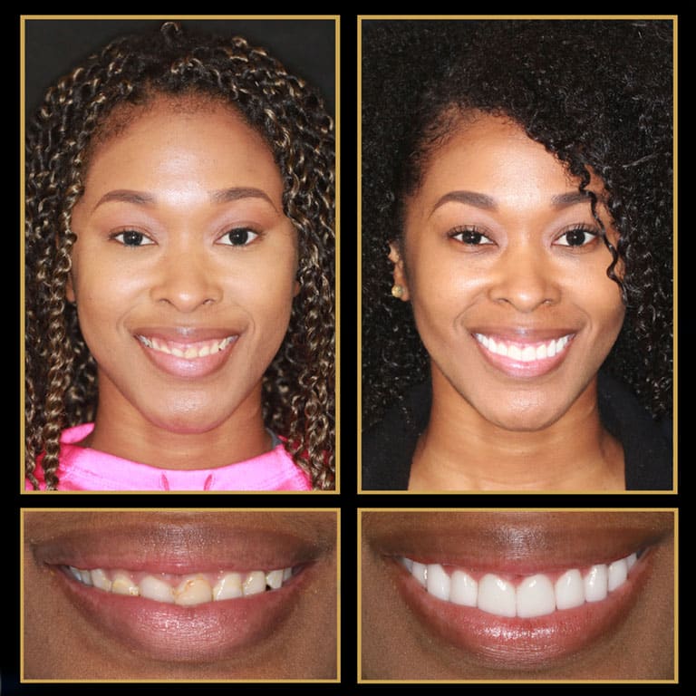 the cosmetic dentists of austin financing options