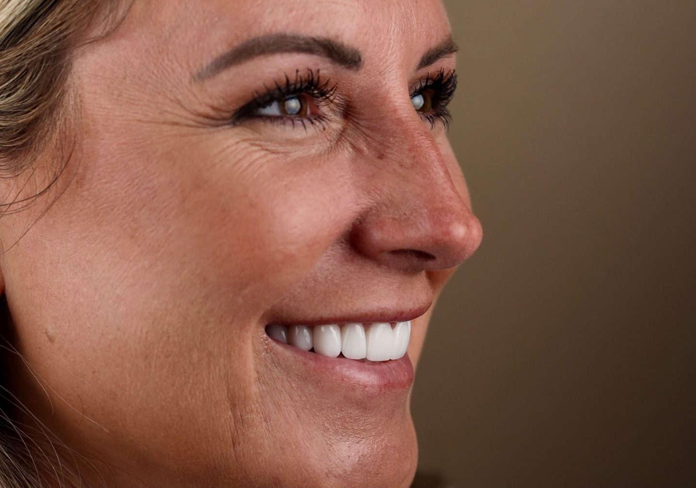 Smiling patient of The Cosmetic Dentists of Austin