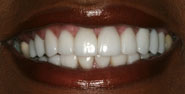 After Image: Case 1 - front