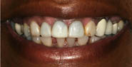 Before Image: Case 1 - front