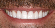 After Image: Case 104 -