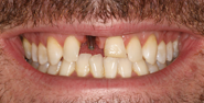 Before Image: Case 104 -