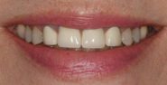 Before Image: Case 119 - front