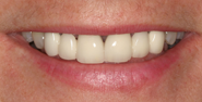 Before Image: Case 123 - front