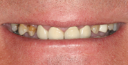 Before Image: Case 129 - front