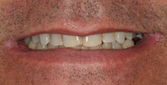 Before Image: Case 135 - front