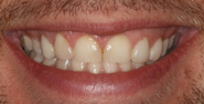 Before Image: Case 136 - front