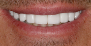 After Image: Case 151 - front