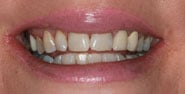 Before Image: Case 172 - front