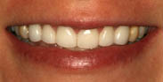 Before Image: Case 18 - front