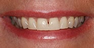 Before Image: Case 184 - front