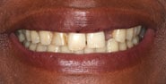 Before Image: Case 188 - front