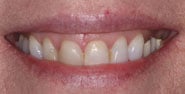 Before Image: Case 189 - front