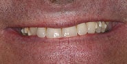 Before Image: Case 196 - front