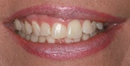 Before Image: Case 197 - front