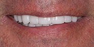 After Image: Case 199 - front