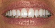 After Image: Case 2 - front