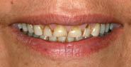 Before Image: Case 2 - front