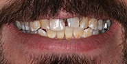 Before Image: Case 207 - front