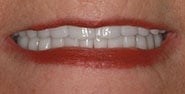 After Image: Case 209 - front