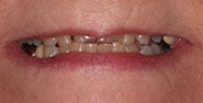 Before Image: Case 209 - front