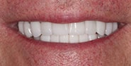 After Image: Case 211 - front