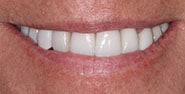 After Image: Case 212 - front
