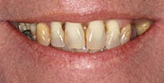 Before Image: Case 212 - front