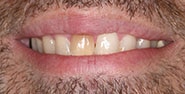 Before Image: Case 220 - front