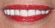 After Image: Case 221 - front