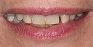 Before Image: Case 221 - front