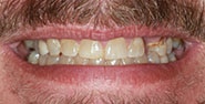 Before Image: Case 226 - front