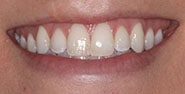 Before Image: Case 227 - front