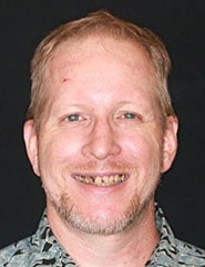 Before Image: Case 229 - front